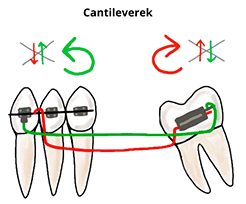 Cantileverek.png