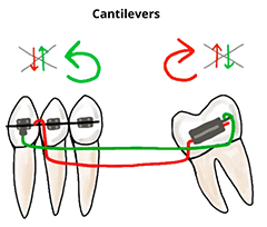 Cantilevers.png