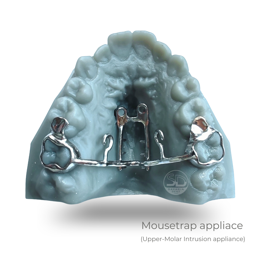 Mousetrap - 2