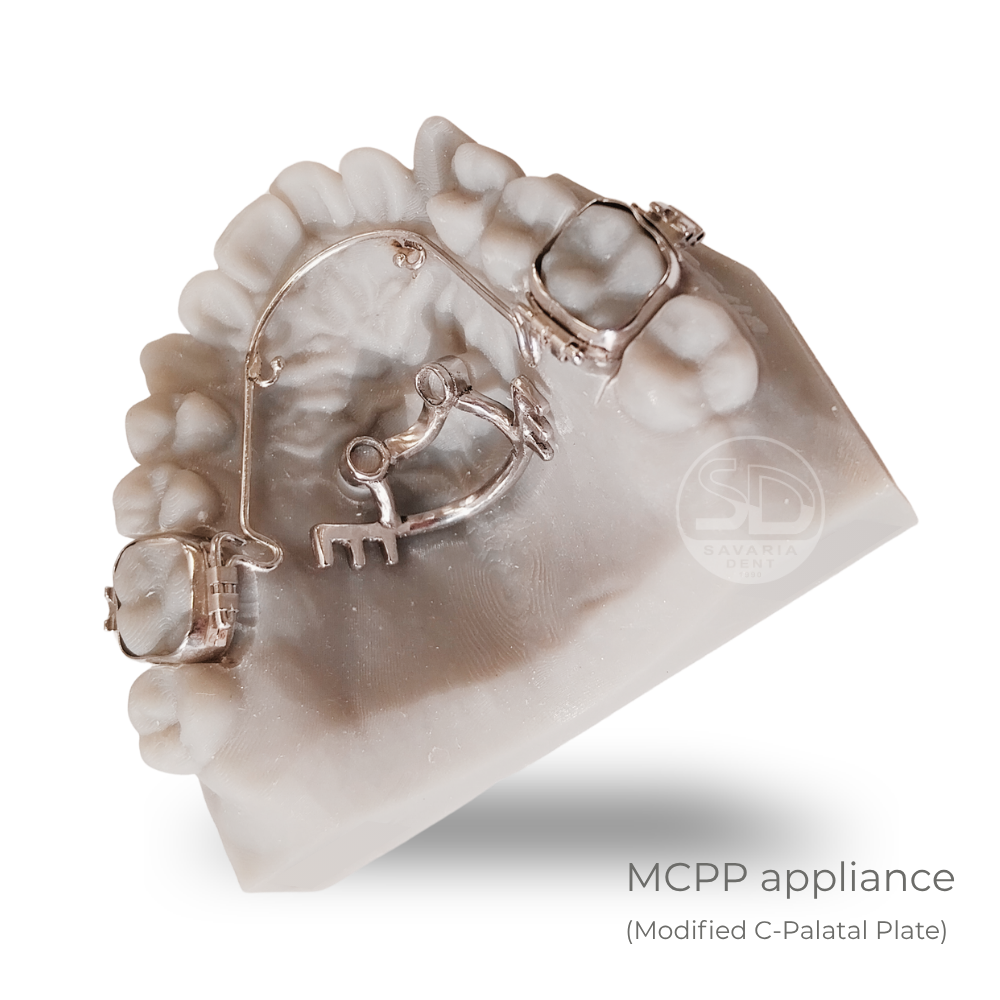 MCPP appliance - 2