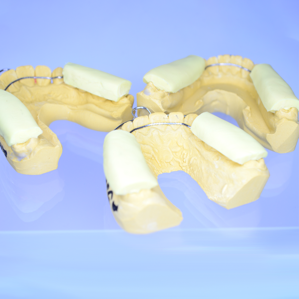 Retainer - 2
