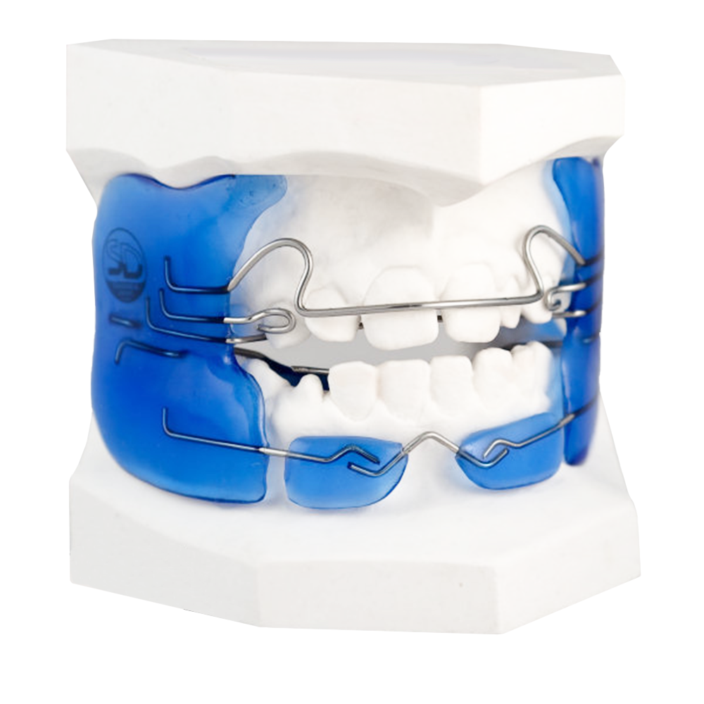 Fränkel orthodontic removable appliance