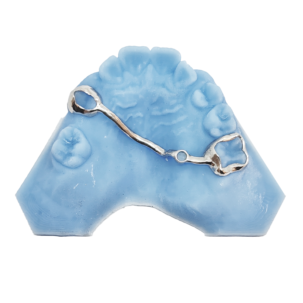 Transpalatal arch fixed orthodontic appliance