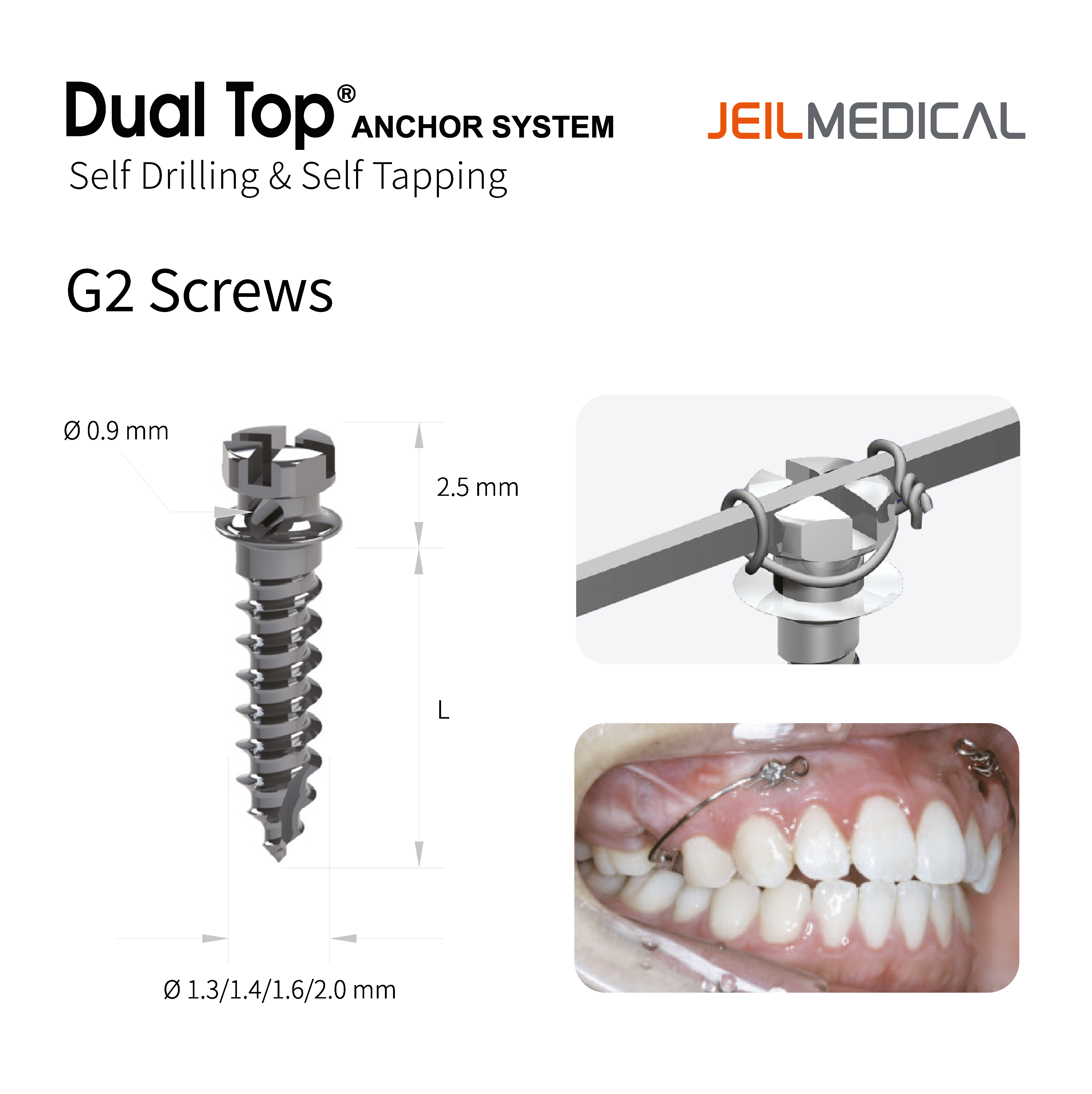 Jeil - Dual Top Anchor Screws - 2