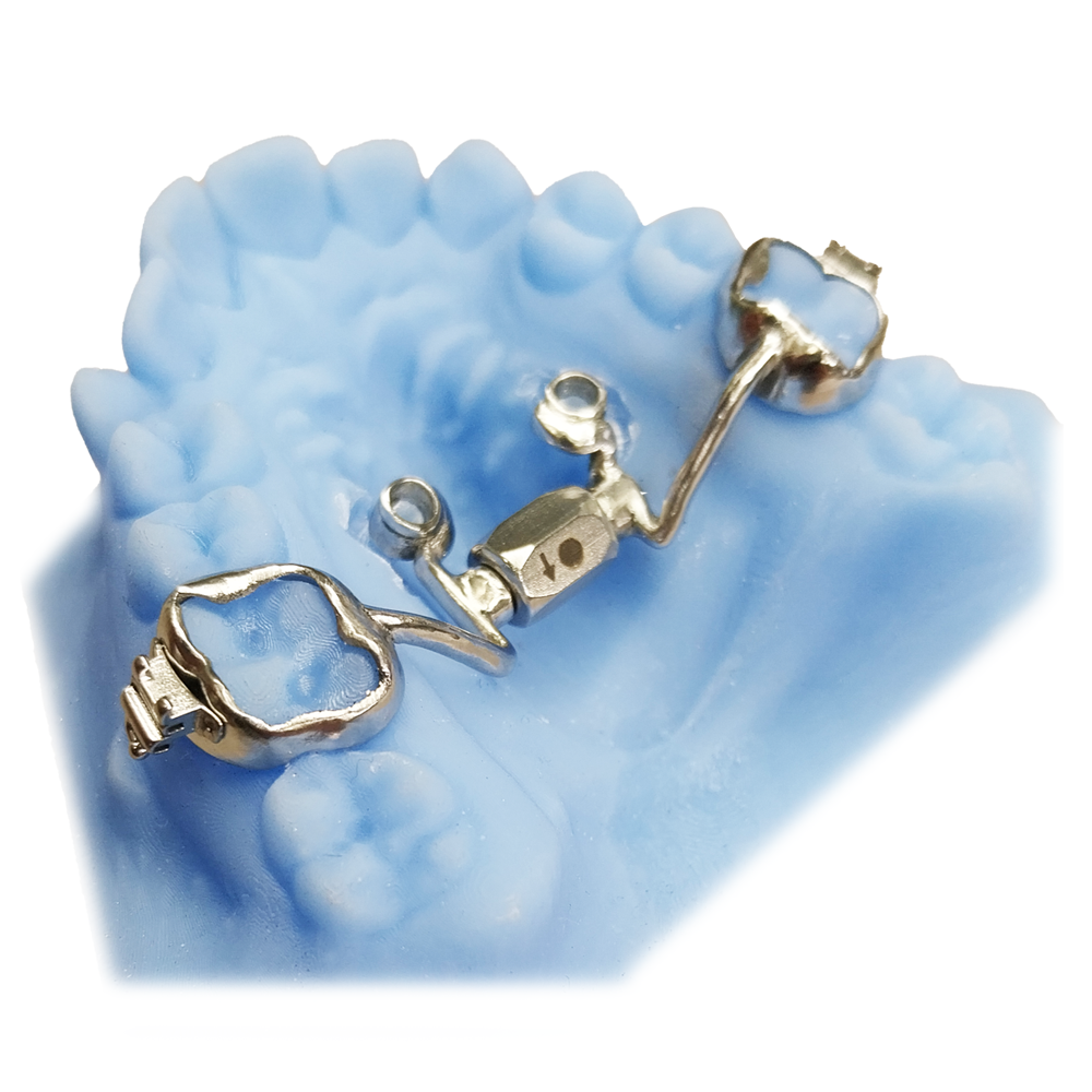 Hybrid Hyrax fixed orthodontic appliance