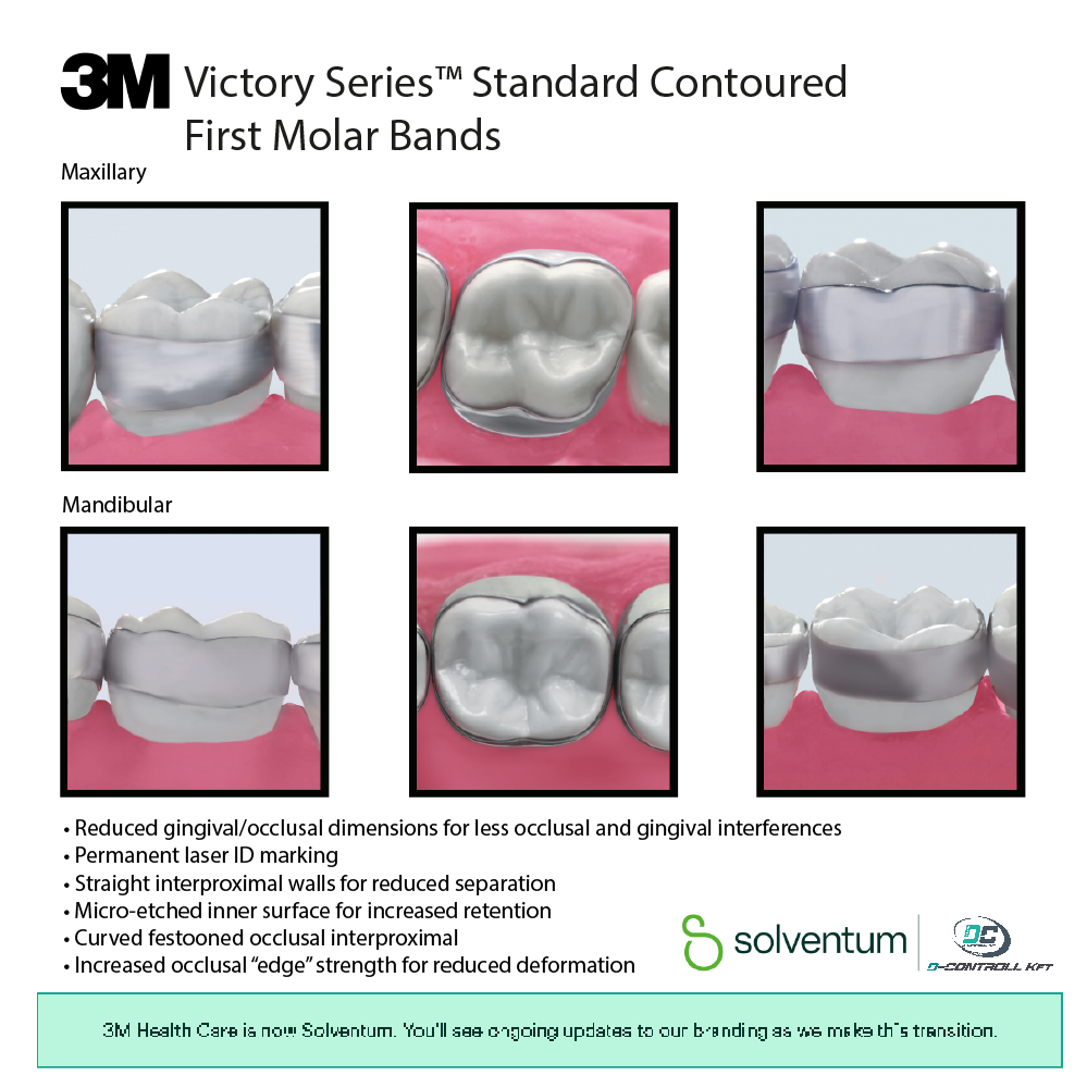 3M Victory Series™ Narrow Contoured First Molar Bands - 2