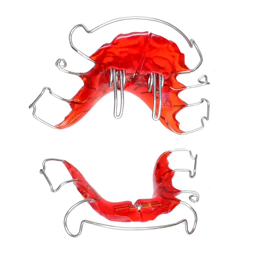 Doppel orthodontic removable appliance