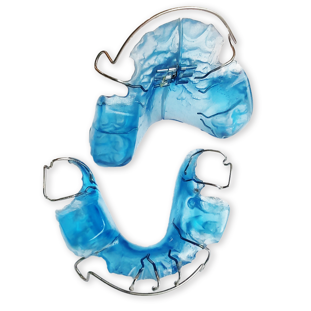 Twin Block removable orthodontic appliance