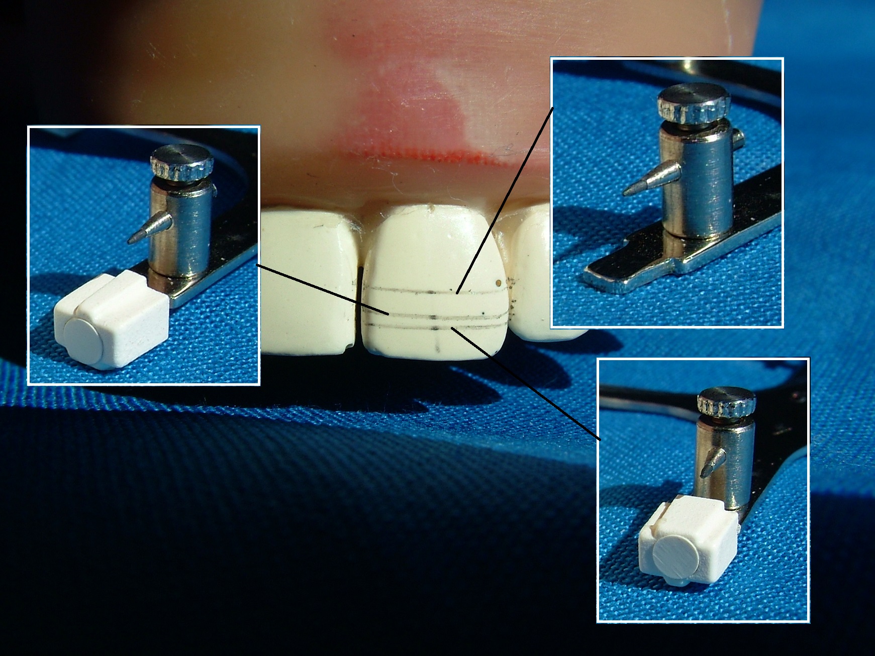 Bracket Height Gauge - 2