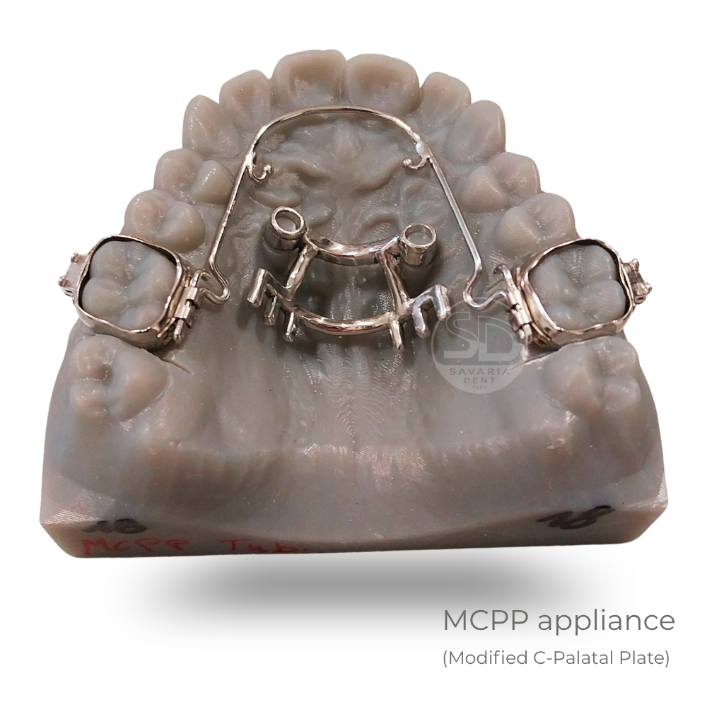 MCPP appliance - 3