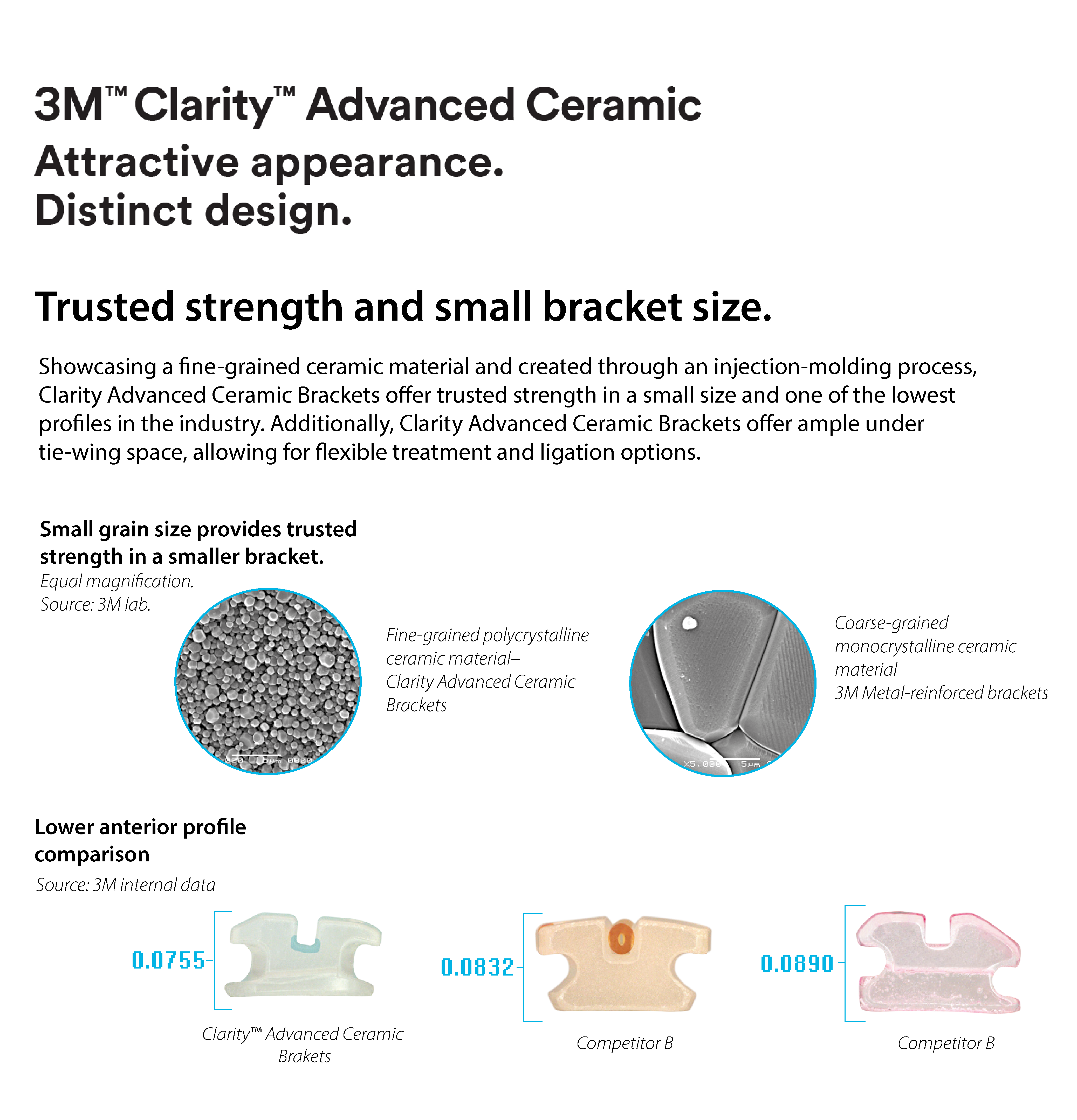 3M™ Clarity™ Advanced Ceramic Brackets - 4