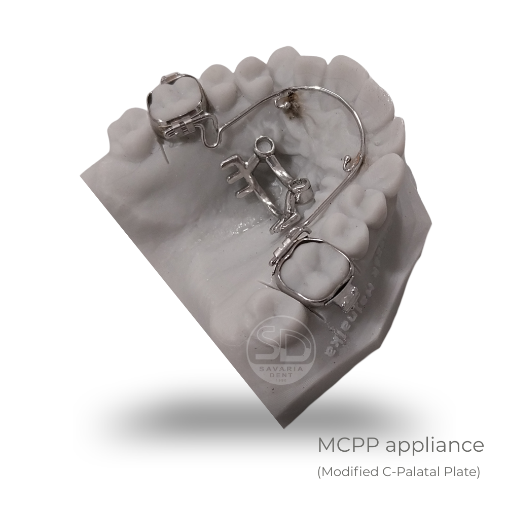 MCPP appliance - 4