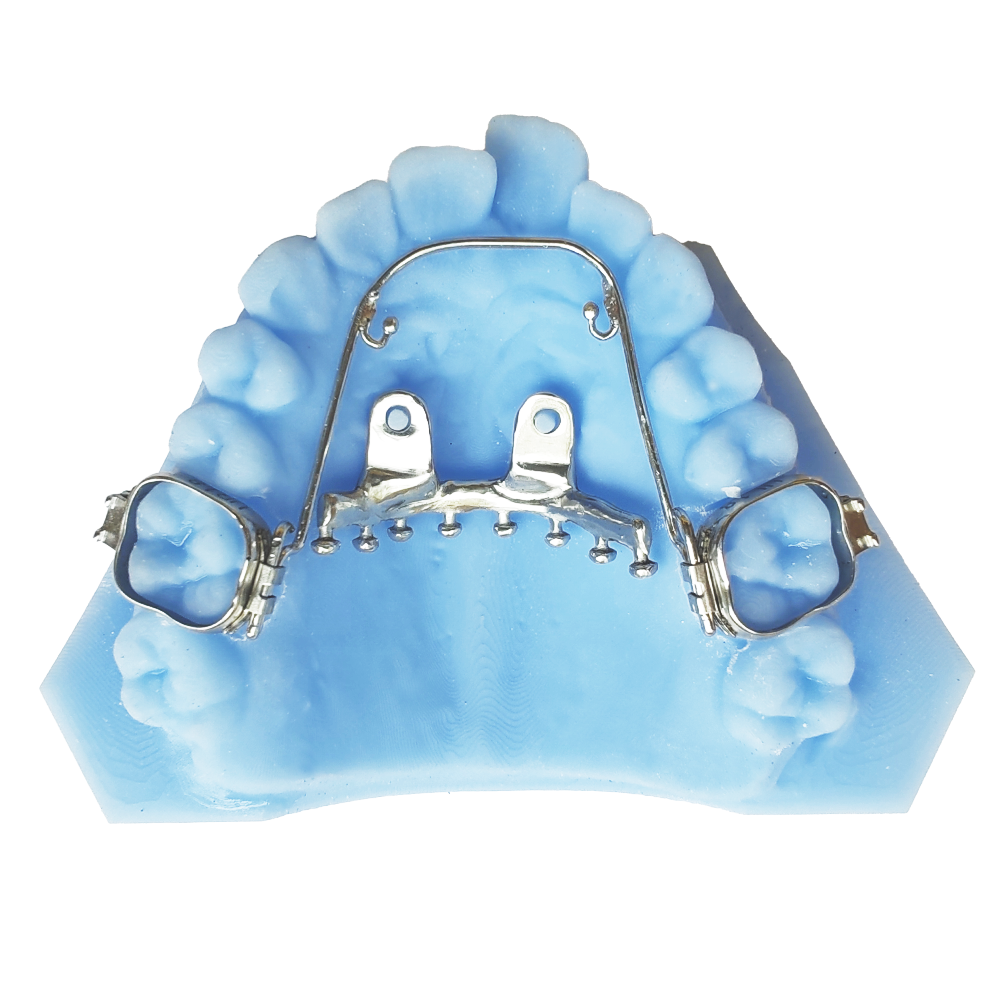 MCPP fixed orthodontic appliance