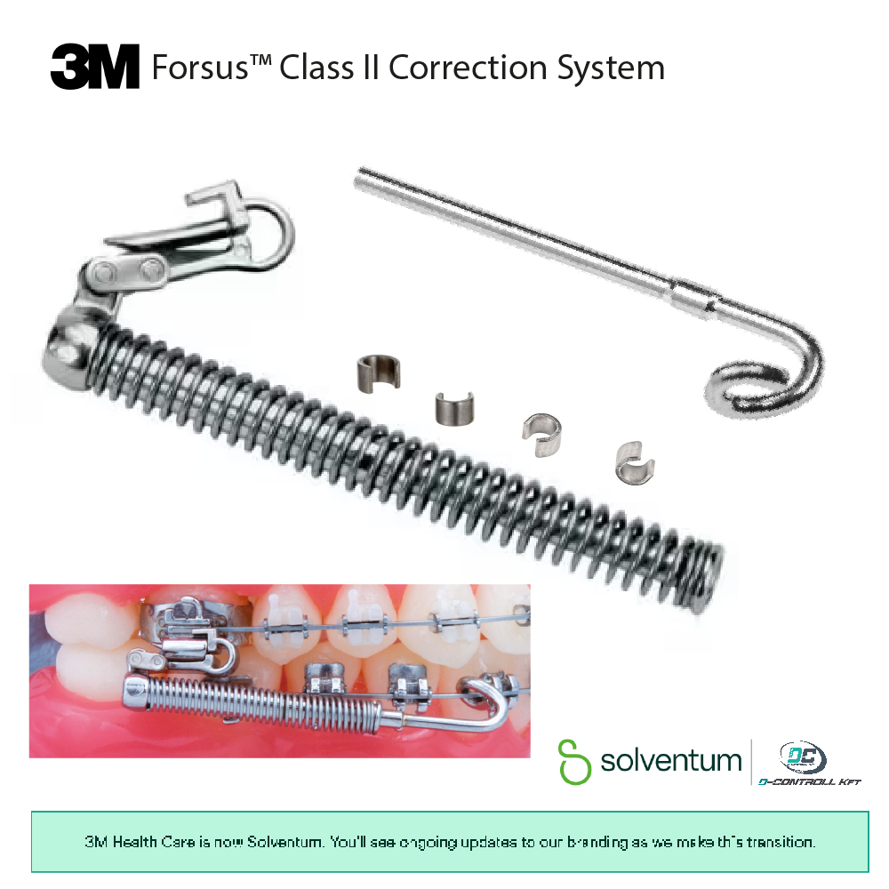 Forsus™ Class II Correction System - 1