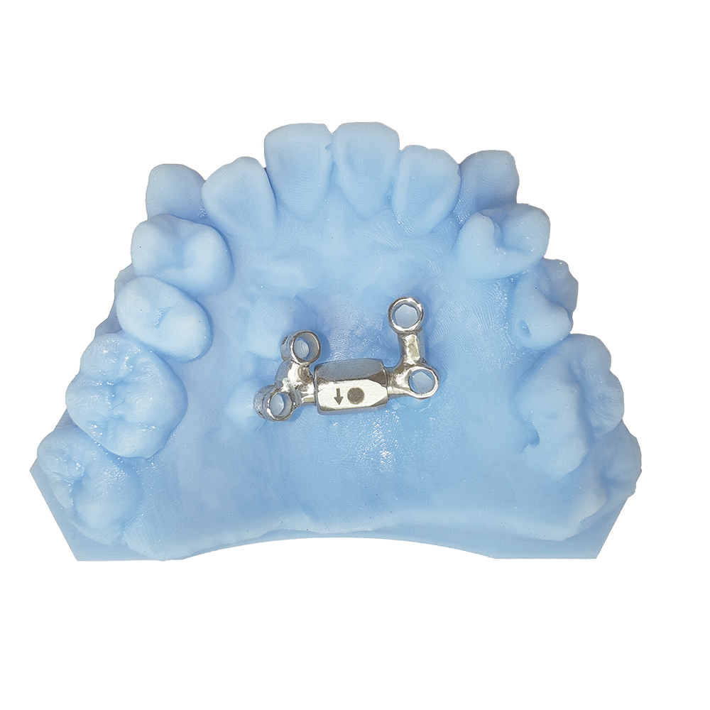 Micro 4 fixed orthodontic appliance