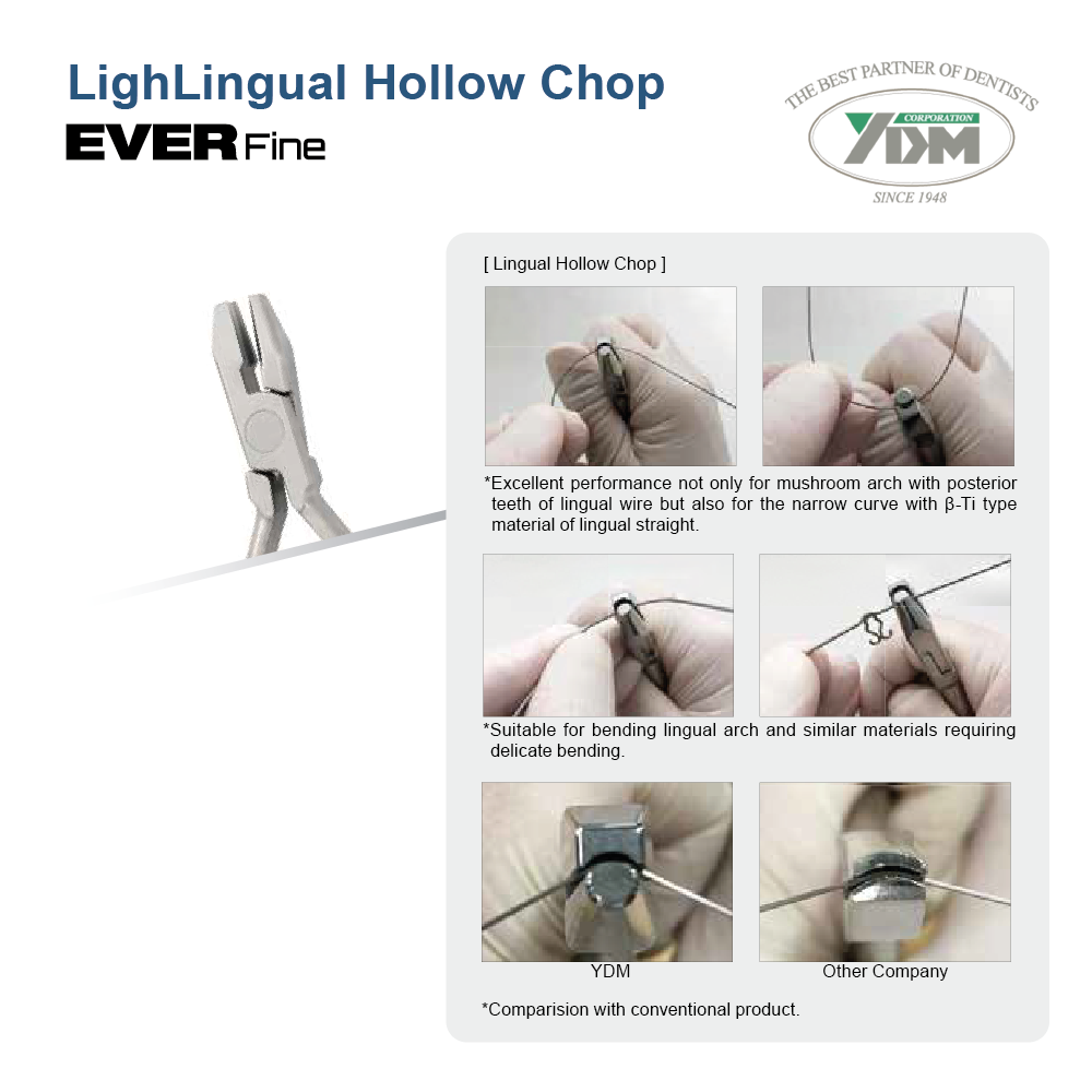 Lingual Hollow Chop - 2