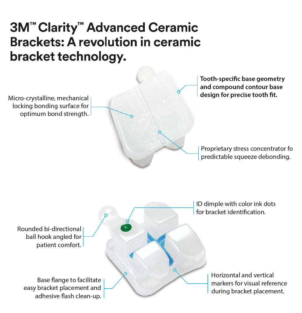 3M™ Clarity™ Advanced Ceramic Brackets - 3