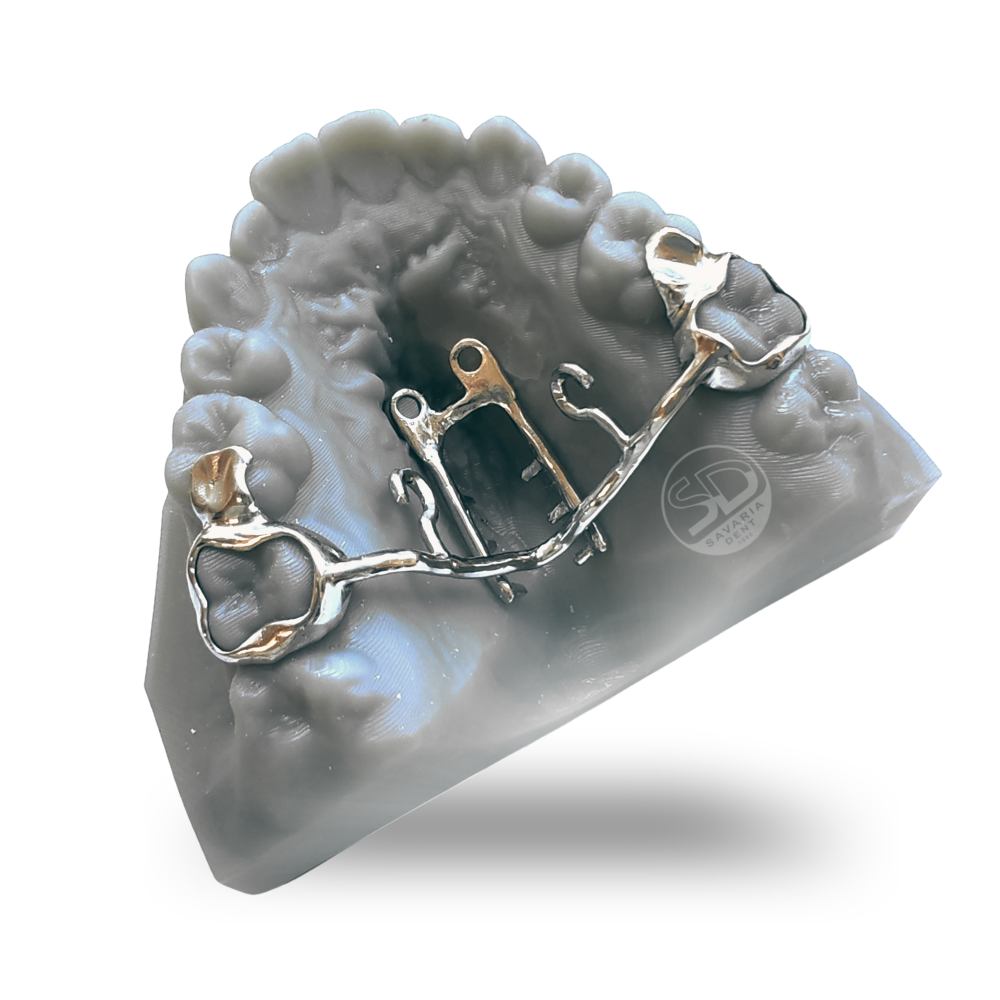 Mousetrap fogszabályozó készülék, rögzített fogszabályozó készülék, mini-implant, elhorgonyzás, TAD, fogtechnika, Savaria-Dent