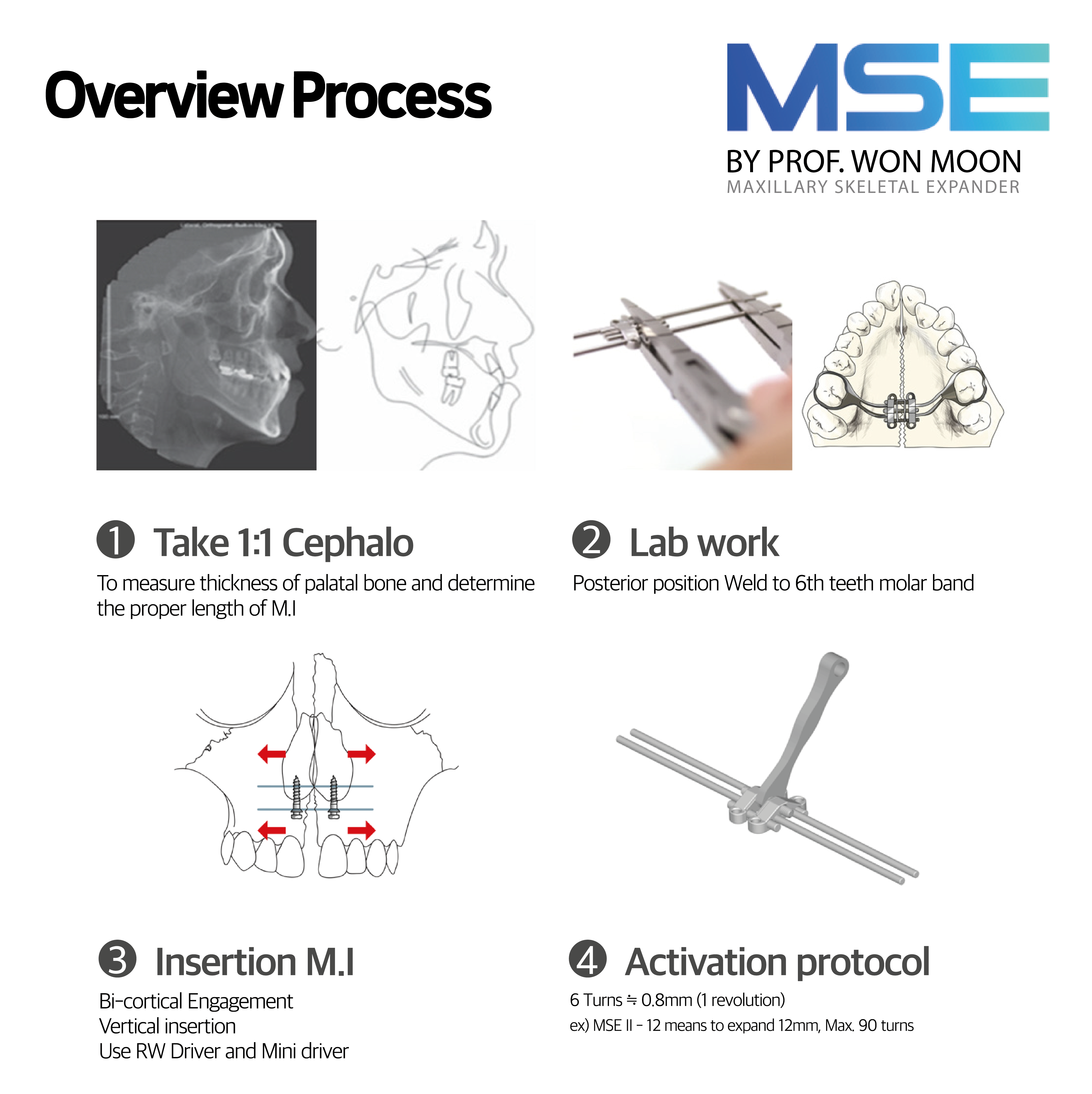 MSE II by Prof Moon - 4