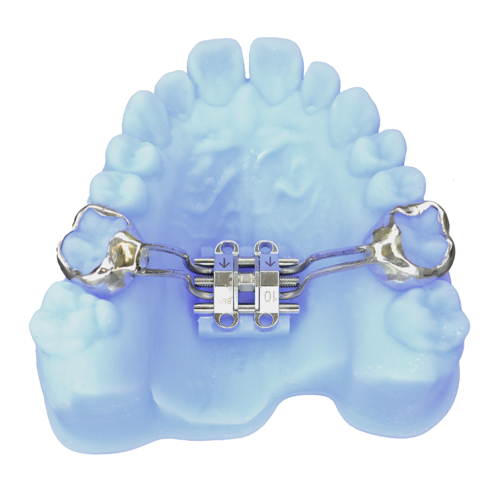 MSE fixed orthodontic appliance